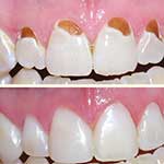 εικόνα Αισθητική Οδοντιατρική 01