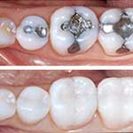 εικόνα Αισθητική Οδοντιατρική 02