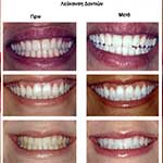 εικόνα Αισθητική Οδοντιατρική 03