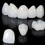 Θήκες και Γέφυρα