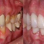 Ακίντητη Προσθετική Εικόνα 01