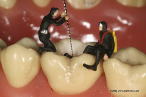 Ενδοδοντία