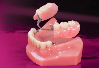 Κινητή Προσθετική