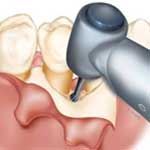 Χειρουργική Στόματος Εικόνα 01