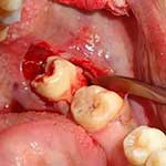 Χειρουργική Στόματος Εικόνα 02